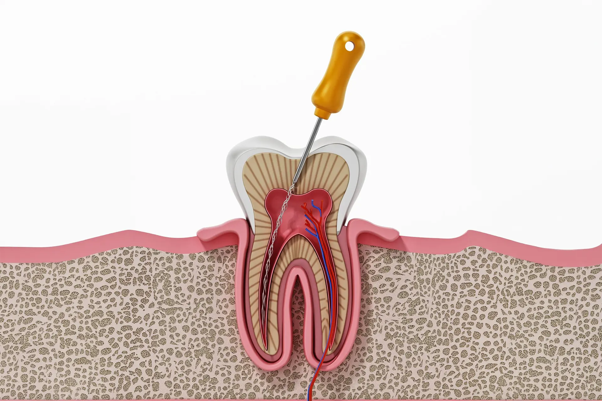 Emergency Root Canal Treatment Leicester Dentist assessing patient for root canal treatment in Leicester